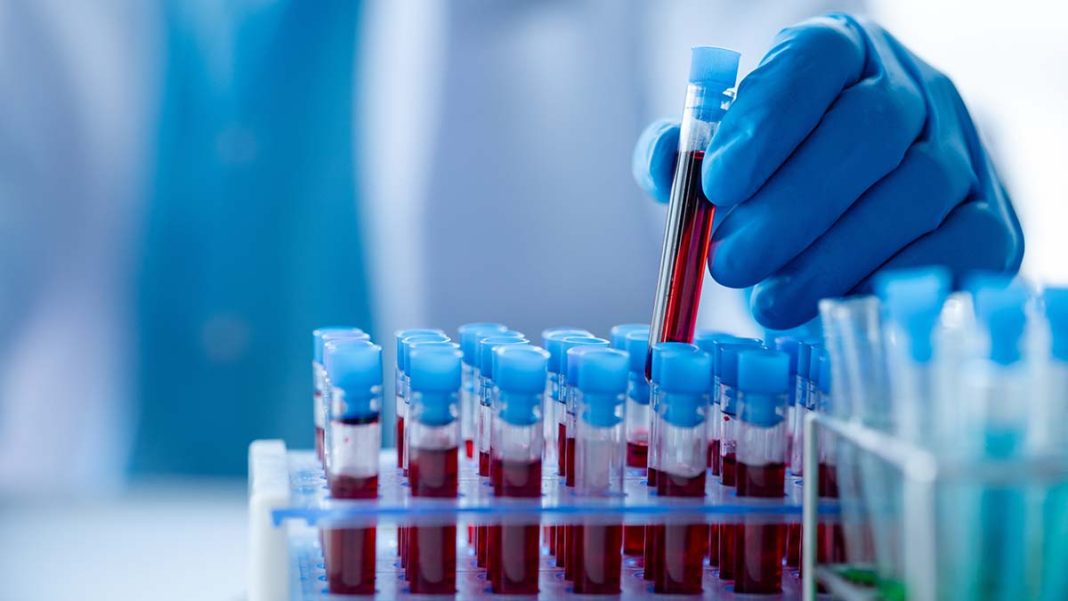Η αποσιώπηση της αλήθειας: Η ανεύθυνη διαχείριση του σκανδάλου με το μολυσμένο αίμα στη Βρετανία 
